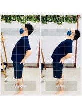 門前仲町イエティ鍼灸整骨院（旧：イエティ鍼灸整骨院）/ビフォーアフター♪