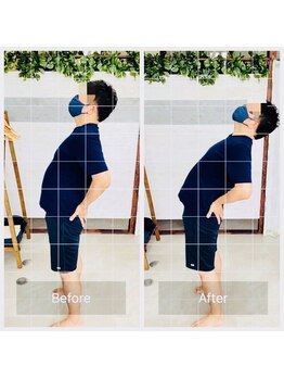 門前仲町イエティ鍼灸整骨院（旧：イエティ鍼灸整骨院）/ビフォーアフター♪