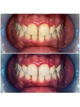 ラシクビューティールーム/ホワイトニング【医療提携】