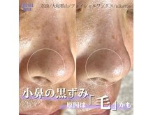 ニカット(nikatto)の雰囲気（フェイシャルワックスでお肌に不要なものを大掃除☆美肌に♪）