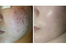 スリリアン 銀座/★お客さまビフォーアフター★