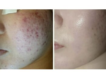 スリリアン 銀座/★お客さまビフォーアフター★