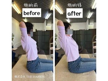 由利本荘整体院/施術ビフォーアフター（姿勢）