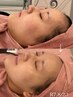 ＼輪郭管理／オリジオ 【輪郭デザイン・小顔・たるみ・もたつき】