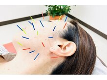 はぴねす整骨院の雰囲気(小顔整体で歪み改善・美容鍼でハリ・ツヤUP)