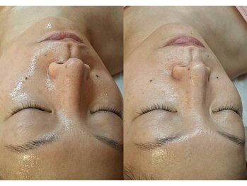 バリューネクスト 青葉台/◆最新ダクトピール◆LHA進化版