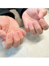 リンネ(Rinne)/ハンドケア