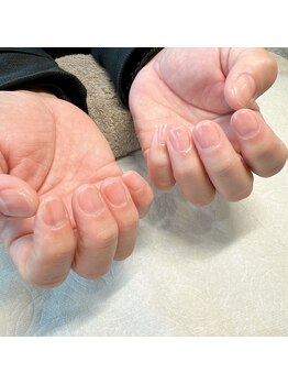 リンネ(Rinne)/ハンドケア