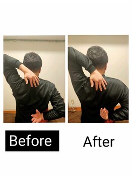 アース エンジェル整体院/ビフォアフ 肩甲骨はがし