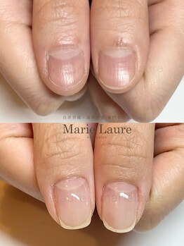 マリーロール 淀屋橋本店(Marie Laure)/自爪育成/深爪矯正/ネイルケア