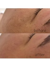 サラ(Sala)/フェイシャルアンプルWAX