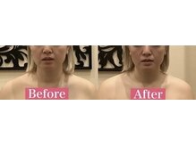 アジール 長岡リバーサイド千秋店(agir)/before/after画像
