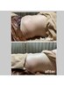 【Body】劇的痩身脂肪撃退美容液注入！結果重視！Lパーツ1部位10000円