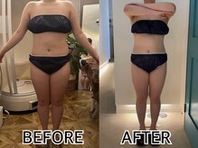 インプルーブ エステティック(Improve ESTHETIC)/〈1年通っているお客様〉