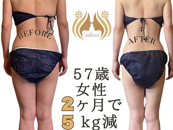 ビハーラ 門司店