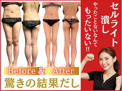フェムビー 千葉駅前店(FEMBE)の写真
