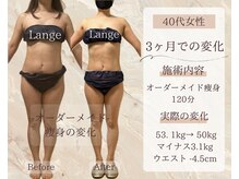 サロン ド ボーテ ラーンジュ 岐阜店(salon de beaut'e L'ange)/ハイパ-ナイフEX2ダイエット痩身