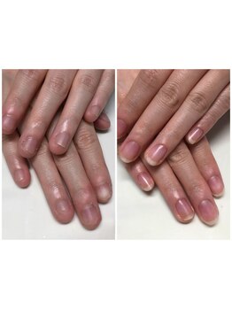 爪の悩みを解消できる（ケア含む）