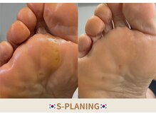 足裏の改善を目的とした方にお勧めです。
