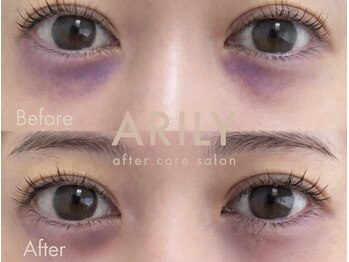 アリリィ(ARILY)/ARILY after care salon