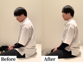 ソレア(Solea)/猫背・肩こり・首こり改善1回目