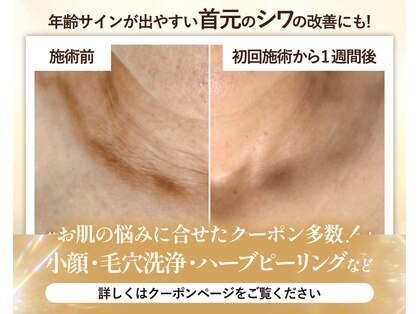 ルポ 鶴見(Repos)の写真