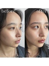 ルーム(room)/ハリウッドブロウリフト