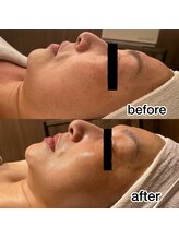 ロカヒ(Lokahi)/ビフォーアフター