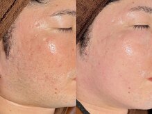 ルーナジェーナ(Luna llena)/池袋　エステ　ルーナジェーナ