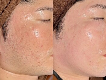 ルーナジェーナ(Luna llena)/池袋　エステ　ルーナジェーナ