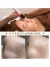 【満足度No.1贅沢プラン】毛穴洗浄＆小顔リンパ＋ドライヘッド80分￥16,000