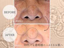 セルベッラ(cerbella)の雰囲気（何歳からでもお肌は綺麗に◎）