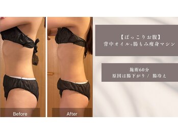 メグリラボ(MEGURI LABO)/たった一度の施術で♪