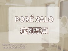 ポレ サロ(pore salo)/【症例写真】