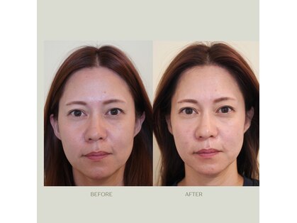 あかり鍼灸接骨院の写真