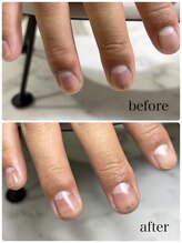 ミレーヴ(MiReve)/ネイルケア