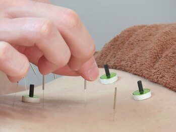 乃々鍼灸整体院 表参道/鍼灸×整体