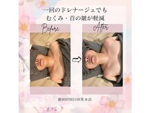創ボディデザイン 茨木店(創 BODY DESIGN)の雰囲気（1回でも猫背が伸びて首が長く見えるように！顔のむくみも解消）