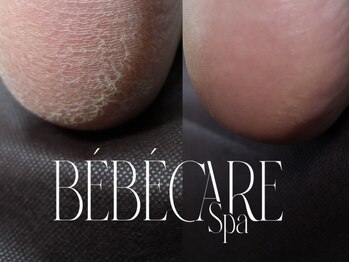 ナンバーアンドスリーサン(No&33)の写真/サンダル映え足元へ。極上べべケア×リファ泡で感動のつるすべ体験！「魅せる足元」へ