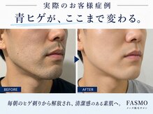 ファスモ(FASMO)