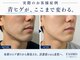 ファスモ(FASMO)の写真