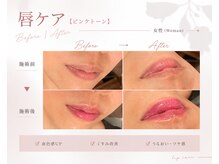 サンバイエム(#3/M)の雰囲気（ピンクトーン導入しました！色持ちを1年間キープするには4回必須）