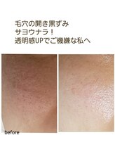 プライベートサロン 美月/