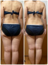 ヨサ パーク コアハート(YOSA PARK CORE HEART)/