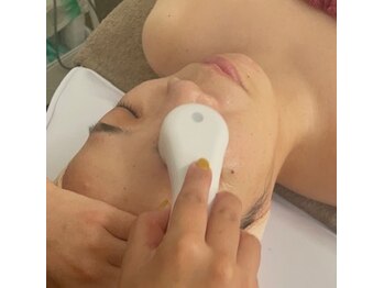 シュシュ(chouchou)/ポレーション