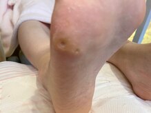 ビサンテ サロン/実績豊富なフットケア角質ケア-2