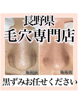 ルネッタ(Lunetta)/