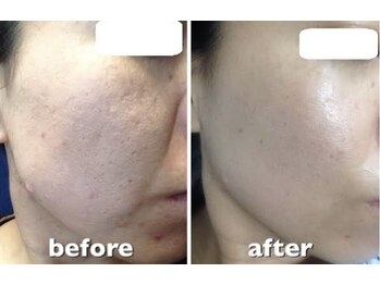 スリリアン 銀座/★お客さまビフォーアフター★