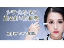 マイティップカワタ(Mytipかわた)/スピキュールフェイシャルエステ