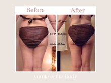 トータルビューティー ゆみえエステ(Total Beauty)/痩身 サイズダウン